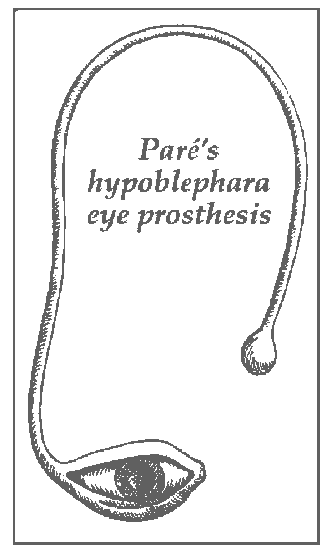 Pares-hypoblephara-rosthetic-artificial-eye