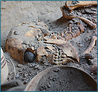 skeleton-fossil-first-prosthetic-eye-artificial-eye-prosthesis-ocular-prosthetics
