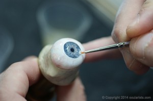 An Ocularist Creates an Eye Prosthesis.