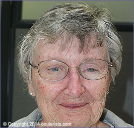 exenteration patient wearing orbital prosthesis