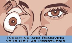 removal-box-prosthetic-eye-artificial-eye-information-eye
