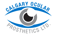 Calgary Ocular Prosthetics