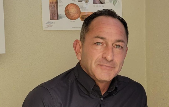 jon imm ocular prosthetics eye replacement